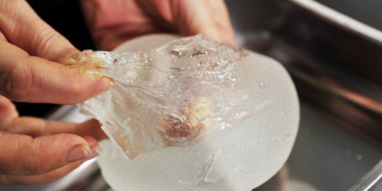 PROCES PROTHESES PIP : LE CAUCHEMAR CONTINUE POUR LES VICTIMES SUD-AMERICAINES