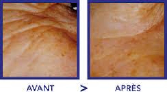 Cuisine : Réaliser un croque McDo maison