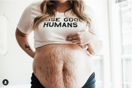 Feel Good : Ces femmes partagent des photos de leur corps, après grossesse