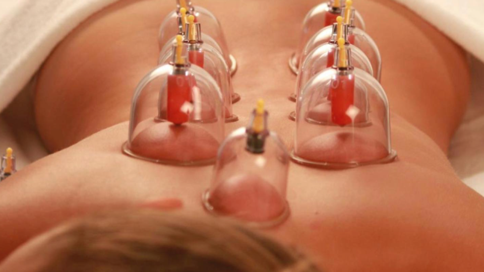 On a testé pour vous : la ventouse thérapie à la Maison du Tui Na !